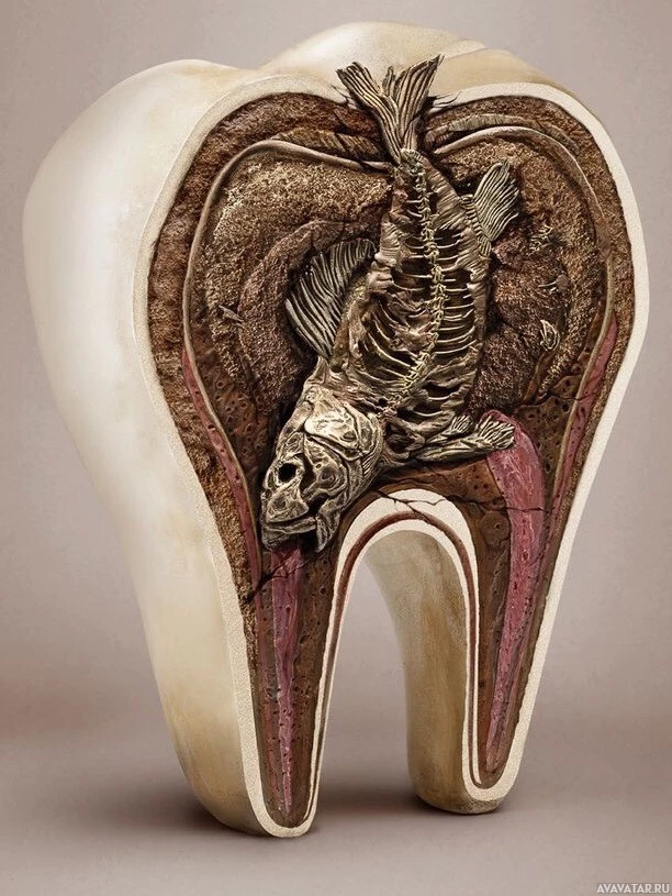 Прикольная стоматологическая модель рыбы в зубной полости